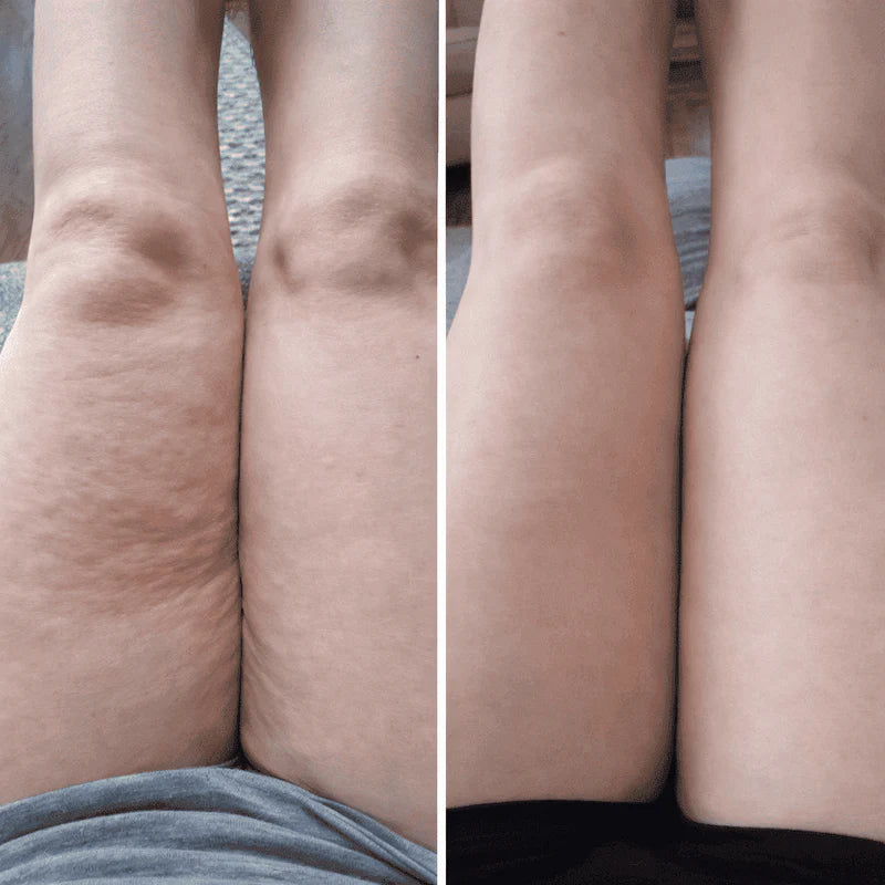 appareil de massage palper rouler a domicile